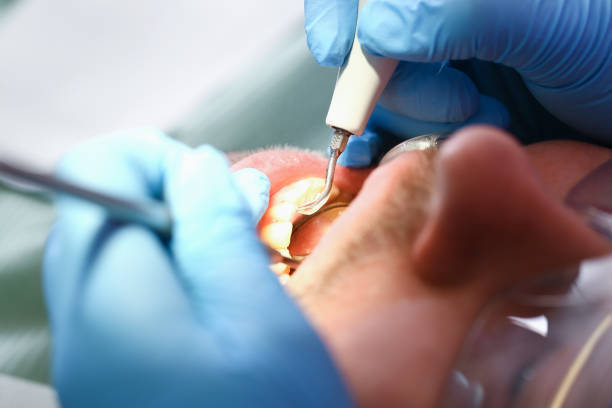Best Walk-In Emergency Dentist in Kenworth, IL
